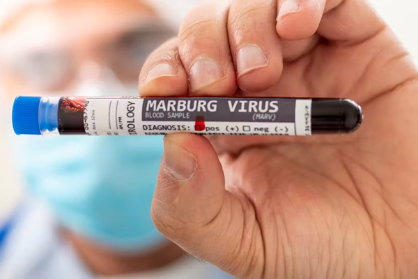 Virus-2