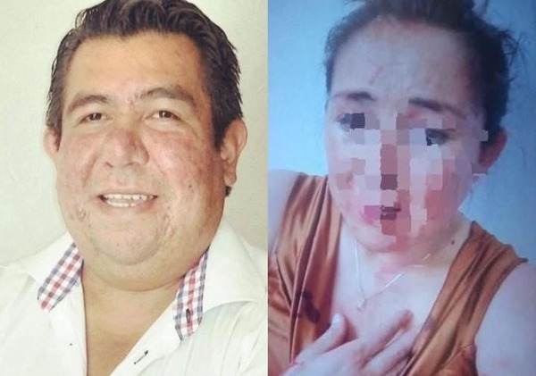 La activista Yeny Charrez denunció en redes al regidor del Ayuntamiento de Tlaxcala, Alejandro N., por agresiones físicas a su esposa