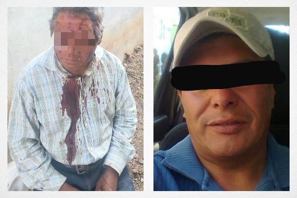 Guarura golpea a ancianito con una arma en Nativitas Cuautempan; familia exige justicia