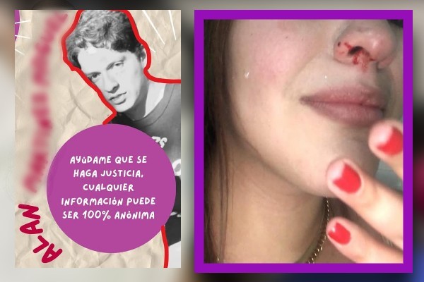 Susyl, alumna de UPAEP es hospitalizada tras ser golpeada por su ex novio; el agresor se da de baja de la institución y huye