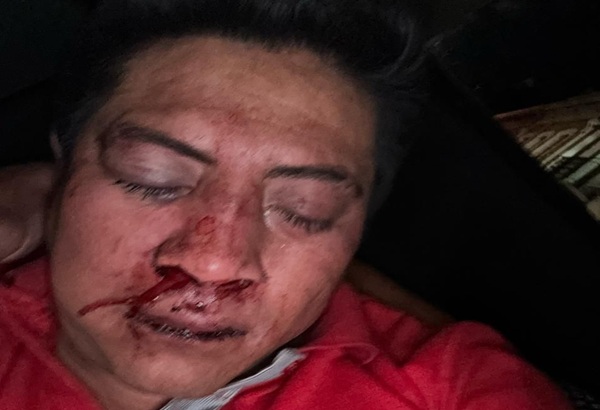 Acusan a meseros del antro El Pre de dar golpiza a jóvenes; establecimiento niega los hechos