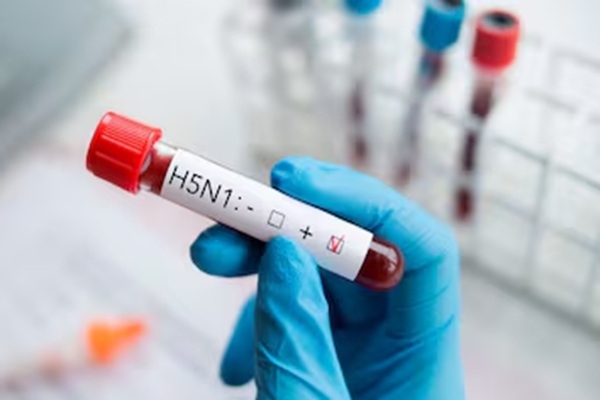 Confirman primer caso humano de influenza aviar H5N1 en México