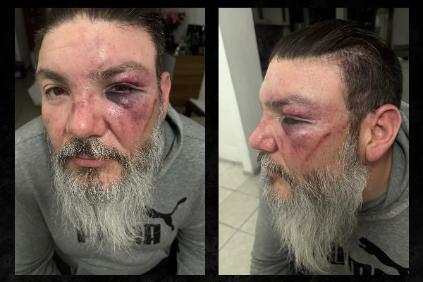 Seudoaficionados golpean y roban a conductor de Sicom y su cuñado, al salir del Cuauhtémoc, tras ver Cruz Azul-Pumas