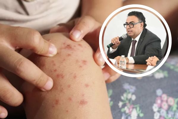 Donde se han concentrado la mayor cantidad de casos confirmados de coxsackie son: Izúcar de Matamoros, Puebla, Tlachichuca y Libres