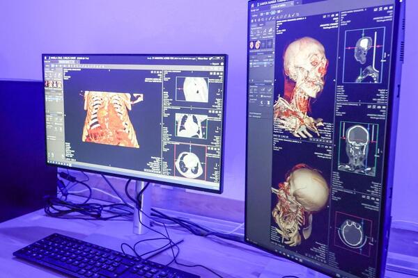 La gobernadora de Tlaxcala destacó que, en su administración, el ITAES pasó de generar 1.5 millones de pesos anuales a 30 millones