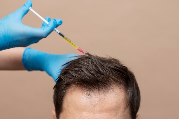 La regeneración capilar no se detiene con aumento , sigue la solicitud de estos procedimientos