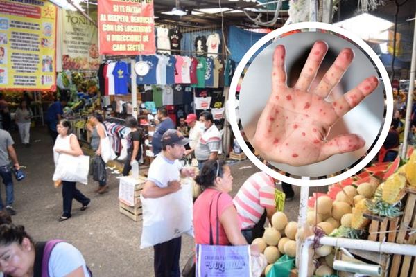 Samuel Aguilar Pala explicó que por el brote de sarampión en el Mercado Hidalgo se hará una campaña de vacunación con mil dosis